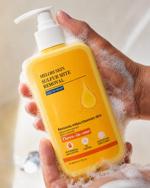 Advanced Sulphur Scabies Wash
