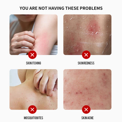 Melori Mite Sulpher Cream